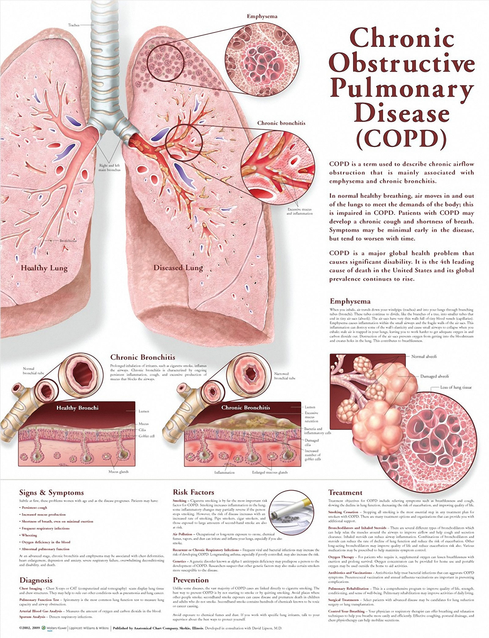 Chronic Obstructive Pulmonary Disease What You Should Know Infographic