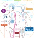 How to avoid migraines infographic
