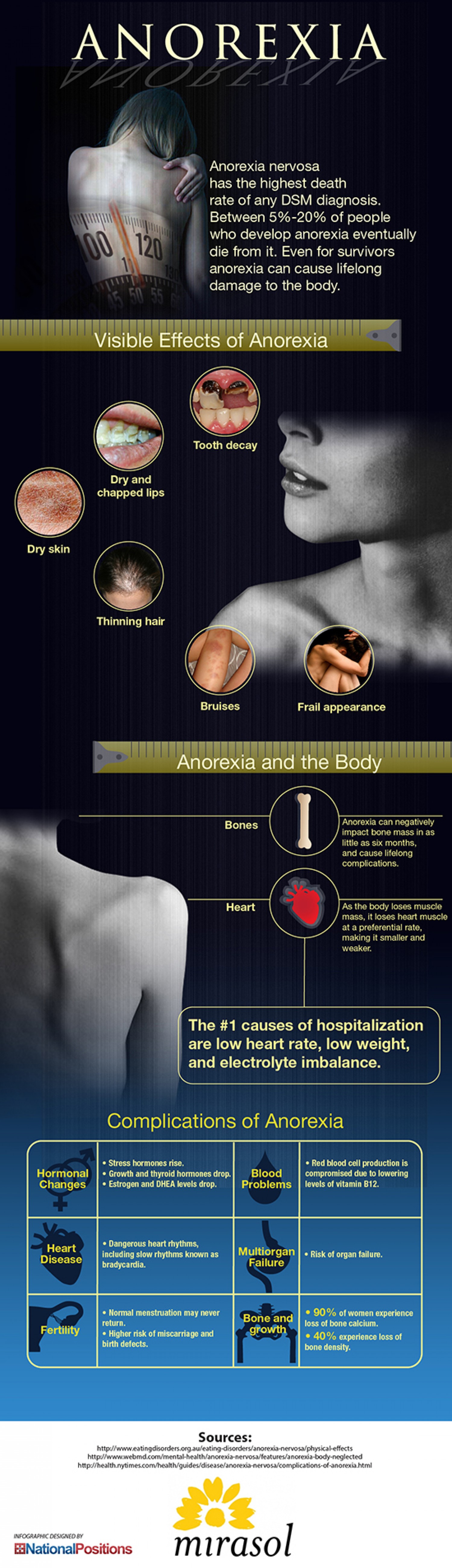 anorexia nervosa effects