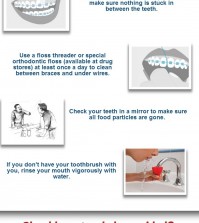 How to take care of your dental brace infographic