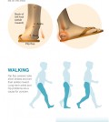 The facts about wearing flip flops infographic