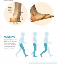 The facts about wearing flip flops infographic