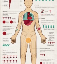 Common causes of death that you should know of so that you could avoid them.
