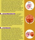 All you need to know about sleep apnea infographic
