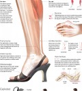 The health problems that wearing high heels could cause you infographic