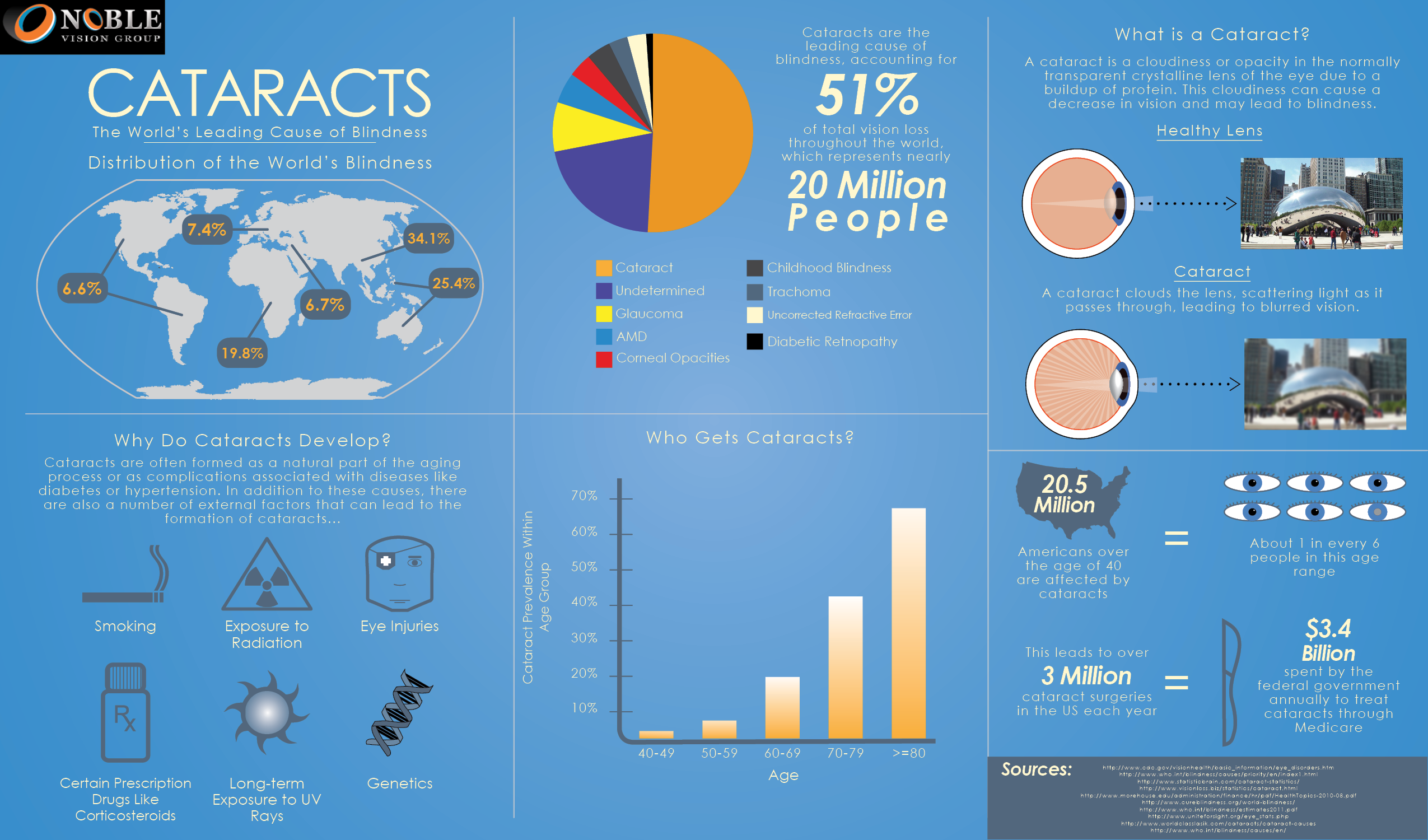 cataract surgery near me cost