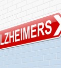 Alzheimers Concept.