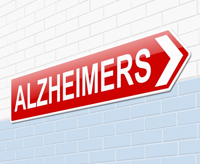 Alzheimers Concept.