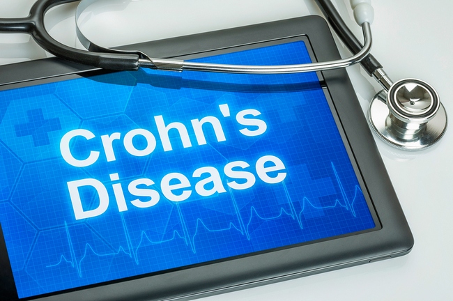 Tablet with the diagnosis Crohn's disease on the display