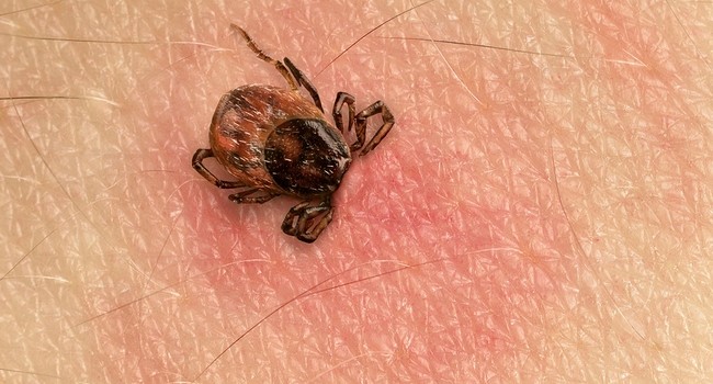 Tick Bite