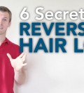 6 Natural Solutions for Reversing Hair Loss Video