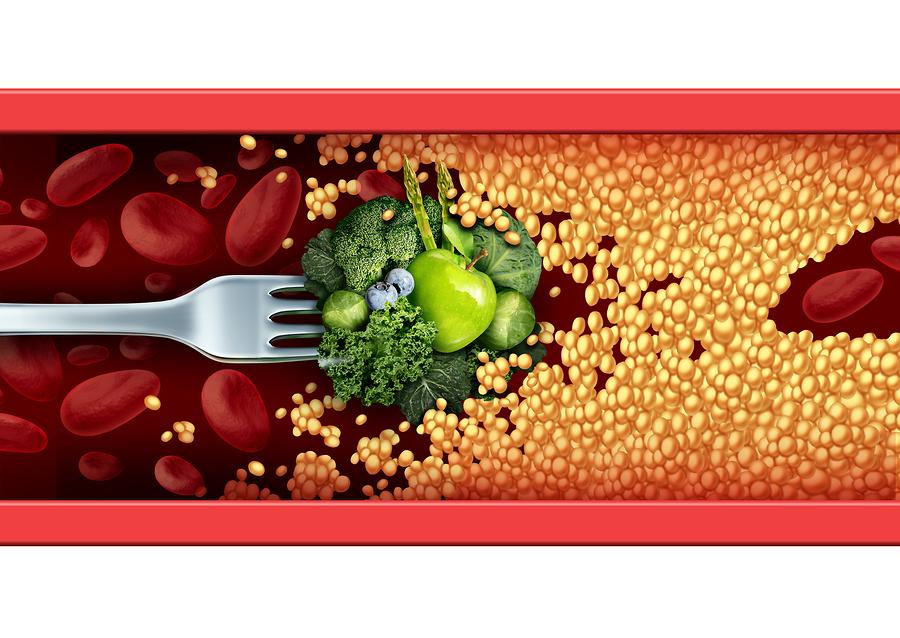 10 Magic Foods That Will Clean Out Your Arteries 10 Magic Foods That Will Clean Out Your Arteries