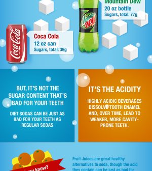 Is Soda Really Bad For Your Teeth? Infographic