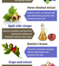 Heal Varicose Veins With These 9 Natural Remedies Infographic