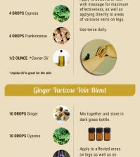 Essential Oil Recipes For Treating Varicose Veins At Home Infographic