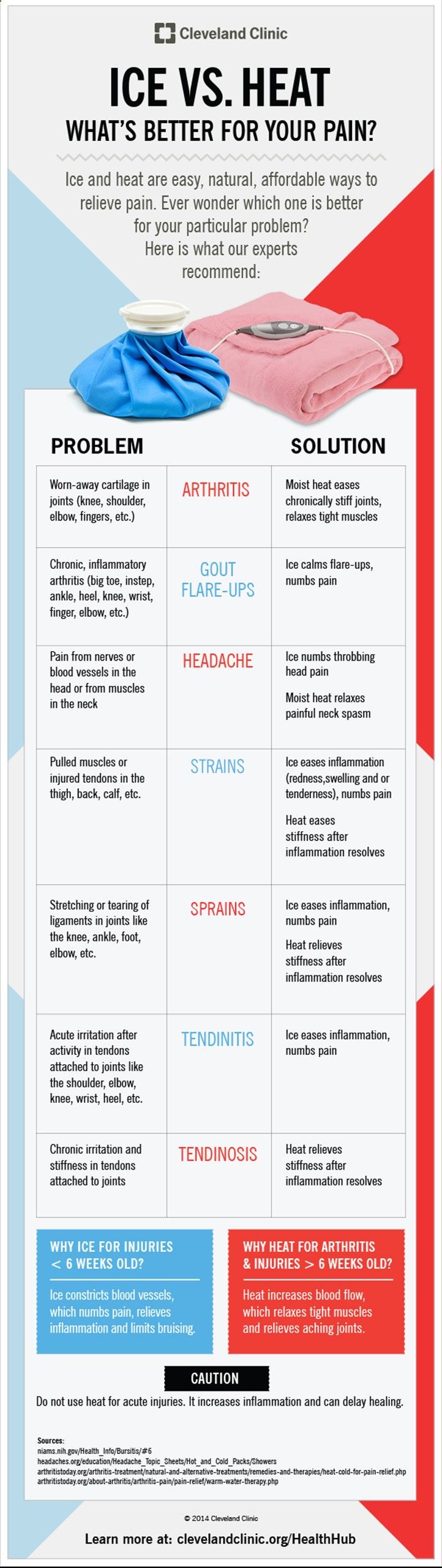 Ice vs Heat: Which Is Better For Different Kinds Of Pain? Infographic