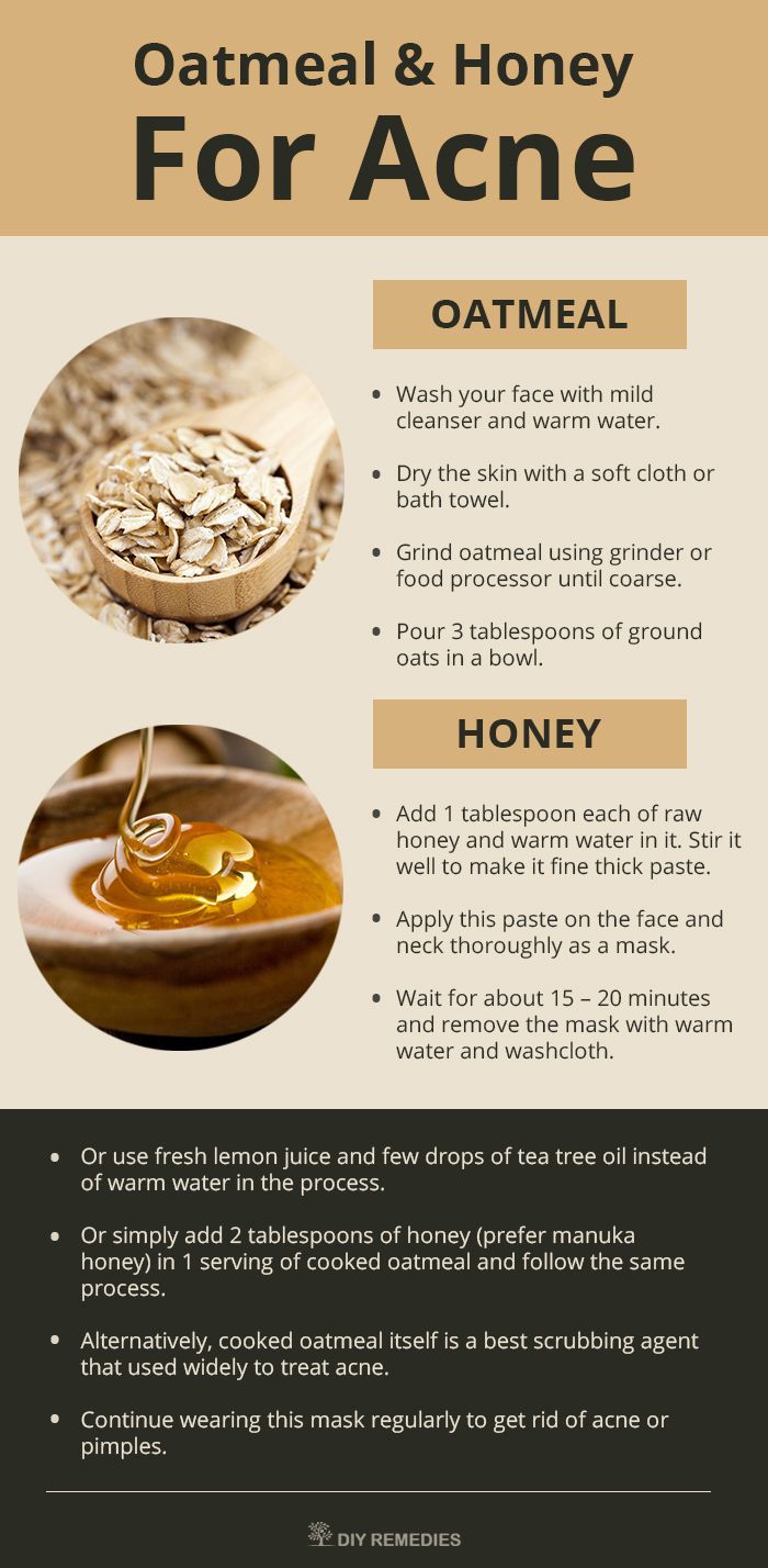 Use The Power Of Oatmeal And Honey To Get Rid Of Acne Infographic