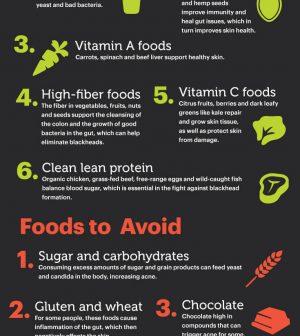 Foods To Eat And Avoid For Blackheads-Free Skin Infographic